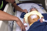 Xót xa bé gái 8 tháng tuổi đã phải trải qua 2 lần phẫu thuật não Xót xa bé gái 8 tháng tuổi đã phải trải qua 2 lần phẫu thuật não