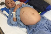Sự sống mong manh của bé trai 10 tuổi phải phẫu thuật u não 5 lần Sự sống mong manh của bé trai 10 tuổi phải phẫu thuật u não 5 lần