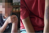 Bé trai bị bố và mẹ kế đánh bầm tím khắp người Bé trai bị bố và mẹ kế đánh bầm tím khắp người