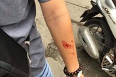Vụ 2 sinh viên bị quản lý trung tâm gia sư đánh chảy máu mũi: Không chấp nhận việc xin lỗi qua loa Vụ 2 sinh viên bị quản lý trung tâm gia sư đánh chảy máu mũi: Không chấp nhận việc xin lỗi qua loa