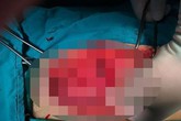4 giờ chạy đua cứu nam thanh niên Hà Nội bị nhiều vết đâm thấu bụng, thấu ngực 4 giờ chạy đua cứu nam thanh niên Hà Nội bị nhiều vết đâm thấu bụng, thấu ngực