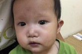 Bé gái 10 tháng tuổi mắc bệnh tim “khất lần” phẫu thuật vì... nghèo Bé gái 10 tháng tuổi mắc bệnh tim “khất lần” phẫu thuật vì... nghèo
