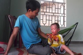 Người cha đau đớn chứng kiến cơ thể con bị bong tróc, ứa máu mỗi ngày Người cha đau đớn chứng kiến cơ thể con bị bong tróc, ứa máu mỗi ngày