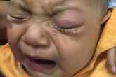 Bé 7 tháng tuổi hỏng mắt vì mẹ nhỏ sữa mẹ chữa đỏ mắt Bé 7 tháng tuổi hỏng mắt vì mẹ nhỏ sữa mẹ chữa đỏ mắt