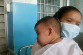 Sởi không có dấu hiệu ngừng tăng, Bộ trưởng Y tế yêu cầu giám sát chặt các ca mắc Sởi không có dấu hiệu ngừng tăng, Bộ trưởng Y tế yêu cầu giám sát chặt các ca mắc