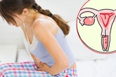 Vì không biết khi nào nên tầm soát ung thư, nhiều người mắc bệnh đã quá nặng Vì không biết khi nào nên tầm soát ung thư, nhiều người mắc bệnh đã quá nặng