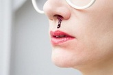 3 triệu chứng khó chịu khi ngủ cảnh báo bệnh nhồi máu não 3 triệu chứng khó chịu khi ngủ cảnh báo bệnh nhồi máu não