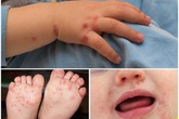 Hãy bảo vệ con bạn bằng việc rửa tay với xà phòng Hãy bảo vệ con bạn bằng việc rửa tay với xà phòng