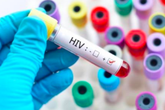3 em bé phơi nhiễm HIV do bị người nghi ngáo đá tấn công, xử lý vết thương ra sao? 3 em bé phơi nhiễm HIV do bị người nghi ngáo đá tấn công, xử lý vết thương ra sao?