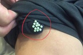 Thấy những hạt nhỏ tý này trên quần áo hay bám trên tường nhà thì phải loại bỏ ngay lập tức Thấy những hạt nhỏ tý này trên quần áo hay bám trên tường nhà thì phải loại bỏ ngay lập tức