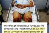 Toàn cảnh vụ Việt kiều bị tạt axit, cắt gân chân ở Quảng Ngãi và những tình tiết bất ngờ Toàn cảnh vụ Việt kiều bị tạt axit, cắt gân chân ở Quảng Ngãi và những tình tiết bất ngờ