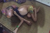 Hoàn cảnh đáng thương của chàng trai liệt tứ chi, mồ côi mẹ, bố bỏ đi Hoàn cảnh đáng thương của chàng trai liệt tứ chi, mồ côi mẹ, bố bỏ đi