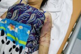Vụ thai phụ bị tra tấn như thời trung cổ đến sảy thai: Mức án nào cho các đối tượng Vụ thai phụ bị tra tấn như thời trung cổ đến sảy thai: Mức án nào cho các đối tượng