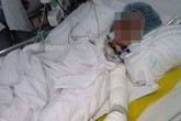 Khốn khổ cả nhà bị bỏng nặng vì rò gas Khốn khổ cả nhà bị bỏng nặng vì rò gas