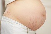 Mẹ bầu trong giỏ nhất định phải có thứ này Mẹ bầu trong giỏ nhất định phải có thứ này