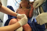 3 trẻ mầm non bỏng nặng vì cô giáo đốt cồn dạy kỹ năng... phòng cháy 3 trẻ mầm non bỏng nặng vì cô giáo đốt cồn dạy kỹ năng... phòng cháy