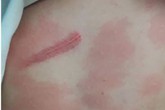 Khởi tố người cô ruột đánh dã man cháu trai 13 tuổi Khởi tố người cô ruột đánh dã man cháu trai 13 tuổi