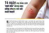 14 ngày mẹ bỉm sữa "mệt nhừ" cùng con sống chung với sốt xuất huyết 14 ngày mẹ bỉm sữa "mệt nhừ" cùng con sống chung với sốt xuất huyết