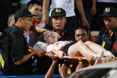 Đốt pháo sáng có thể dẫn đến những hiểm họa khôn lường như thế nào? Đốt pháo sáng có thể dẫn đến những hiểm họa khôn lường như thế nào?