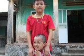Xót thương gia cảnh 2 anh em bị tật nguyền ở mắt Xót thương gia cảnh 2 anh em bị tật nguyền ở mắt
