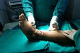'Cậu nhỏ' và các phần cơ thể bị đứt rời: Phải bảo quản cách này thì bác sĩ mới nhất định cứu được 'Cậu nhỏ' và các phần cơ thể bị đứt rời: Phải bảo quản cách này thì bác sĩ mới nhất định cứu được