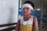 Sức khỏe của cô bé 8 tuổi bị bỏng cồn cả người thoát chết kỳ diệu hiện ra sao? Sức khỏe của cô bé 8 tuổi bị bỏng cồn cả người thoát chết kỳ diệu hiện ra sao?