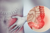 8 căn bệnh mà cẩn thận còn "sống chung với lũ", sơ sẩy thì vào ngay "cửa tử": Nam giới cần để tâm 1 thì nữ giới phải chú ý 10 8 căn bệnh mà cẩn thận còn "sống chung với lũ", sơ sẩy thì vào ngay "cửa tử": Nam giới cần để tâm 1 thì nữ giới phải chú ý 10