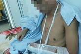 Nam Định: Chậm trả tiền lãi, một nam thanh niên bị đánh nhập viện Nam Định: Chậm trả tiền lãi, một nam thanh niên bị đánh nhập viện