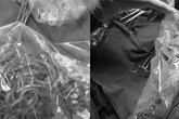 Bé trai bị tắc ruột, bác sĩ gắp ra 100 con giun Bé trai bị tắc ruột, bác sĩ gắp ra 100 con giun