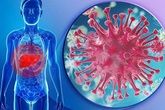 28 tuổi đã ung thư gan: Thủ phạm rất phổ biến, có người biết mắc nhưng chủ quan không để ý 28 tuổi đã ung thư gan: Thủ phạm rất phổ biến, có người biết mắc nhưng chủ quan không để ý