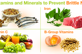 4 loại vitamin và khoáng chất ngăn ngừa móng tay giòn và dễ gãy 4 loại vitamin và khoáng chất ngăn ngừa móng tay giòn và dễ gãy