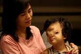 Mẹ của cô bé có khuôn mặt biến dạng ở Quảng Bình gửi con để đi giúp người dân chống lũ Mẹ của cô bé có khuôn mặt biến dạng ở Quảng Bình gửi con để đi giúp người dân chống lũ