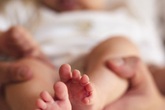 Cắt khối u khổng lồ ở ngực cho bé 3 ngày tuổi Cắt khối u khổng lồ ở ngực cho bé 3 ngày tuổi