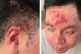 Làm rõ vụ nhân viên quán bar đánh khách vì mời rượu không uống Làm rõ vụ nhân viên quán bar đánh khách vì mời rượu không uống