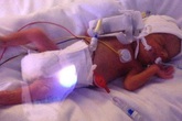 Bé gái mắc bệnh hiểm nghèo khó sống, bác sĩ bất lực trả về gia đình nhưng hành động chơi đùa vô tư của chị gái đã cứu em thoát khỏi "Tử thần" Bé gái mắc bệnh hiểm nghèo khó sống, bác sĩ bất lực trả về gia đình nhưng hành động chơi đùa vô tư của chị gái đã cứu em thoát khỏi "Tử thần"