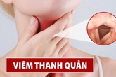 Tại sao hàng triệu người bị khản tiếng tin dùng Tiêu Khiết Thanh hỗ trợ điều trị hơn 10 năm qua? Tại sao hàng triệu người bị khản tiếng tin dùng Tiêu Khiết Thanh hỗ trợ điều trị hơn 10 năm qua?