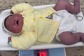 Hy hữu: Bé trai ở Hà Nội vừa chào đời đã nặng gần 6kg Hy hữu: Bé trai ở Hà Nội vừa chào đời đã nặng gần 6kg