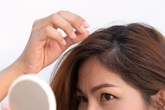 3 cách trị tóc bạc, rụng tóc dễ mua, dễ làm lại hiệu quả cho người trẻ tuổi 3 cách trị tóc bạc, rụng tóc dễ mua, dễ làm lại hiệu quả cho người trẻ tuổi