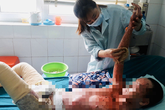 Bình ga mini phát nổ, cháu bé ở Hà Tĩnh bị bỏng 71% mà không có tiền chữa trị Bình ga mini phát nổ, cháu bé ở Hà Tĩnh bị bỏng 71% mà không có tiền chữa trị