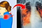 Có 5 dấu hiệu này chứng tỏ phổi của bạn đang "kêu cứu", tuyệt đối không được chủ quan Có 5 dấu hiệu này chứng tỏ phổi của bạn đang "kêu cứu", tuyệt đối không được chủ quan