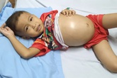 Xót xa cháu bé 5 tuổi bụng to như trống vì căn bệnh hiểm nghèo Xót xa cháu bé 5 tuổi bụng to như trống vì căn bệnh hiểm nghèo