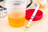 Triệu chứng và cách chữa suy thận hiệu quả Triệu chứng và cách chữa suy thận hiệu quả