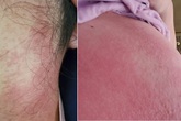 Phát hoảng với những cách làm đẹp sau sinh dễ gặp biến chứng Phát hoảng với những cách làm đẹp sau sinh dễ gặp biến chứng