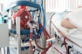 2 phổi của phi công mắc COVID-19 "đông đặc", đang xem xét ghép phổi 2 phổi của phi công mắc COVID-19 "đông đặc", đang xem xét ghép phổi