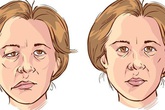 Phòng ngừa đột quỵ đúng cách – Bước đi quan trọng để bảo vệ sức khỏe! Phòng ngừa đột quỵ đúng cách – Bước đi quan trọng để bảo vệ sức khỏe!