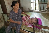 Người đàn bà bệnh tật 30 năm chật vật nuôi chồng, con bị bệnh não úng thủy Người đàn bà bệnh tật 30 năm chật vật nuôi chồng, con bị bệnh não úng thủy