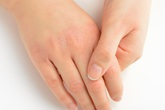 10 dấu hiệu cơ thể bạn đang mang trọng bệnh hoặc sức khỏe tụt dốc 10 dấu hiệu cơ thể bạn đang mang trọng bệnh hoặc sức khỏe tụt dốc