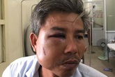 Chủ quán cà phê đạp vào mặt nhân viên cây xanh bị khởi tố Chủ quán cà phê đạp vào mặt nhân viên cây xanh bị khởi tố