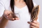 Chị em đừng dại mà động vào các loại thực phẩm này nhiều nếu không chẳng mấy chốc mà hói đầu Chị em đừng dại mà động vào các loại thực phẩm này nhiều nếu không chẳng mấy chốc mà hói đầu