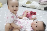 Hai bé gái dính nhau sắp được mổ tách Hai bé gái dính nhau sắp được mổ tách